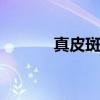 真皮斑是什么样的图片 真皮斑