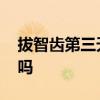 拔智齿第三天能刷牙么 拔智齿第三天能刷牙吗