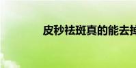 皮秒祛斑真的能去掉吗 皮秒